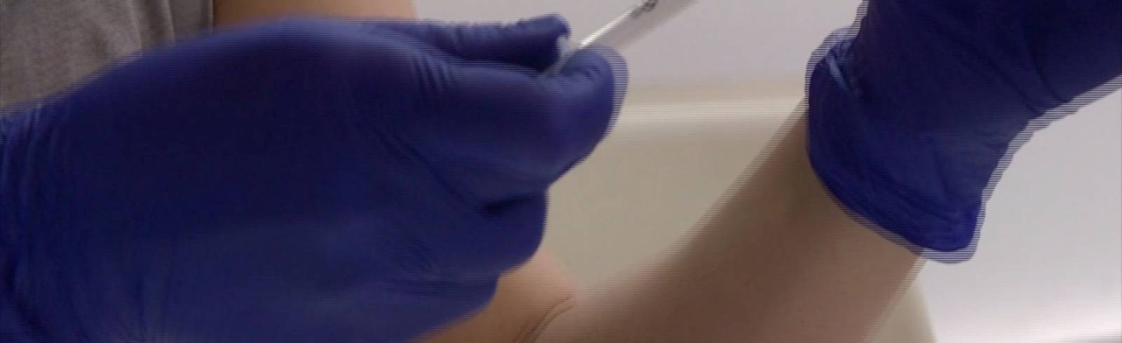 Lösung für Genesene mit Impfung im Grünen Pass