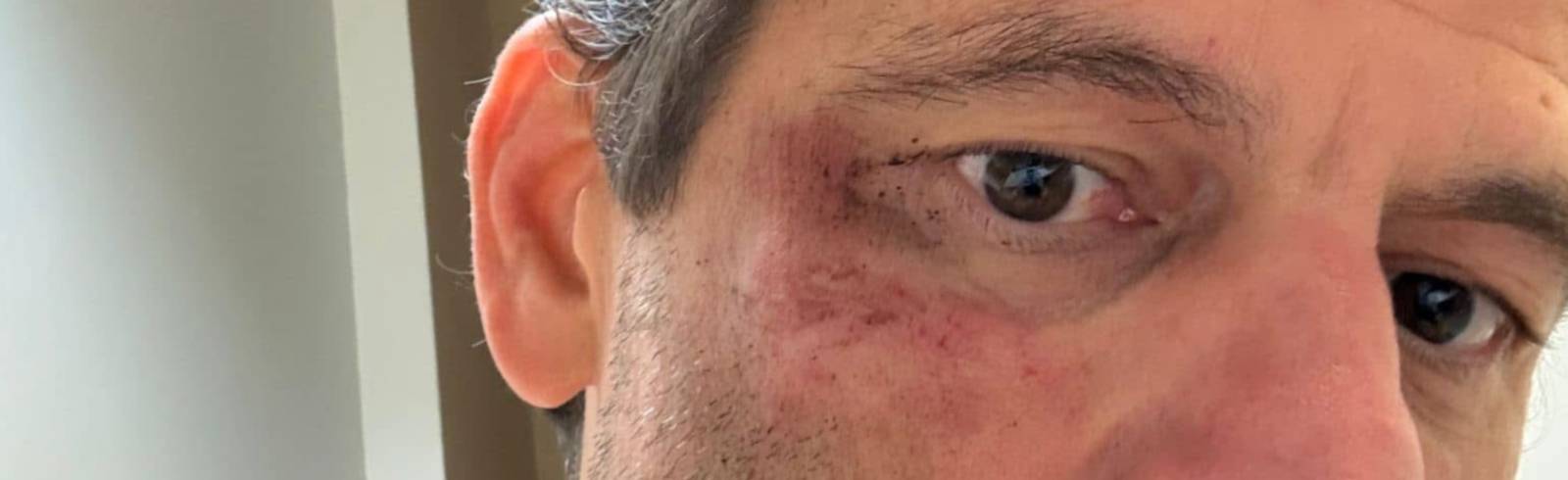 Neun Monate bedingt für Vösendorfs Ex-Bürgermeister Koza