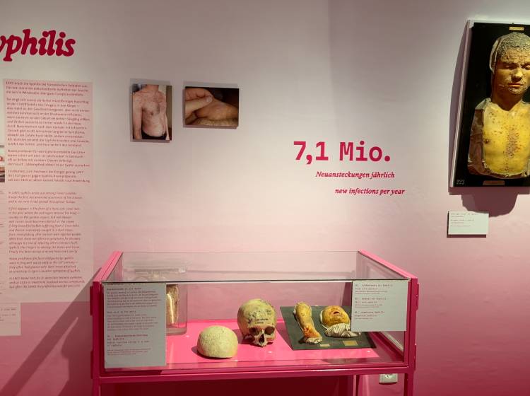 Safe Sex: Neue Ausstellung über Geschlechtskrankheiten